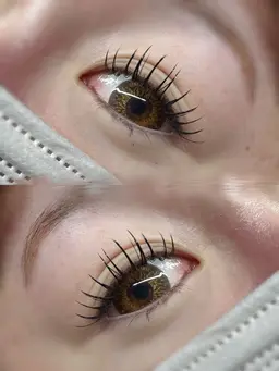 【パッチテスト】はじめての方・不安な方に◎