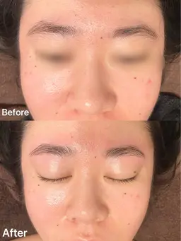 【ミニモ学割】ハリウッドブロウリフト(HBL)自眉をいかした自然な眉に♪ カウンセリング→眉癖改善→ワックス脱毛→毛抜き