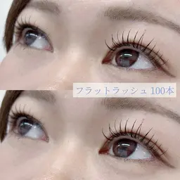 フラットラッシュ100本