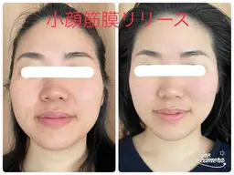 小顔に✨首こりに‼️カワハギ‼️⭐︎独自の技術で丁寧に頭皮とお顔の筋膜をリリース