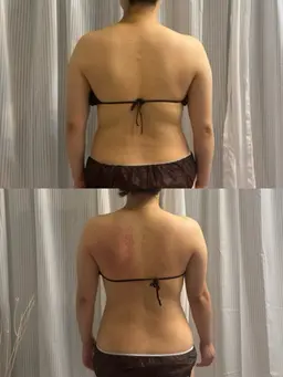 全身痩身　cavi × RF ×vacuum × EMS ×heatmat 150min 【表参道限定】