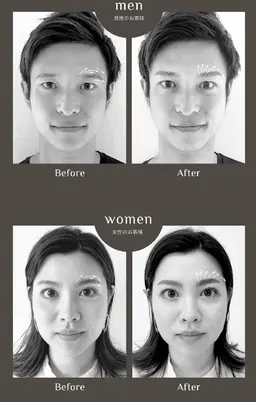 パリジェンヌブロウリフト、