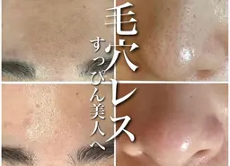 【まずはお試し】毛穴チェック/毛穴洗浄