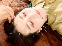 HARIKARA式美容鍼&美容整体でコンプレックスを改善◎