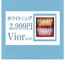 歯のセルフホワイトニング3回照射 (1回あたり999円)