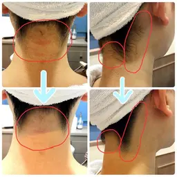 襟背中シェービング(女性限定)