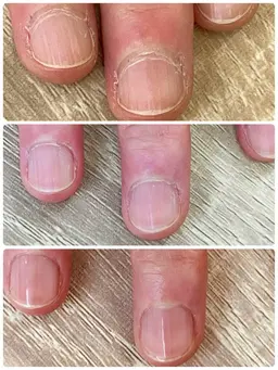 指先コンプレックス解消！美爪育成ネイルケア