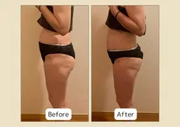 【人気No.1】最先端よもぎ蒸し＋痩身小顔美肌ケア90分¥13,800→¥7,800