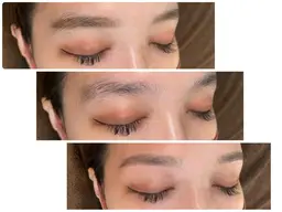 ハリウッドブロウリフト