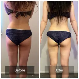 【破格全身痩身！】全身集中コース