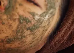 🌿国産ハーブピーリング🌿　2部位選んで