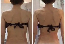 背中​〜​二の腕部分の痩身✨