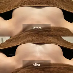 人気No. 1🌟クリスマスに向けて🎄たった一度でボリュームUP・ハリ・弾力・下垂・左右差改善!! ふわふわバストケア