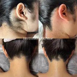 成人式前人気No.1👘【うなじ+もみあげワックス脱毛】