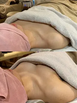 🌹産後の下垂に🌹【本気のバストケア】全身施術120分(ホットストーン付き🤍)＋下着フィッティング＋ホームケア