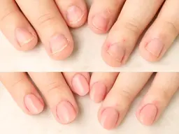 深爪矯正長さだし １カラーorグラデーション