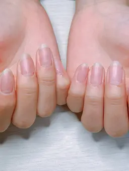 自爪風クリアネイル