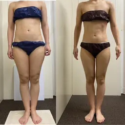 🔥本気痩せ×全身フル痩身🔥《5980円→2980円》1台でW効果✨