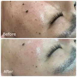 大人気王道🫅メニュー【毛穴洗浄✖️美白鎮静マスク】毛穴の黒ずみ＆開き＆角栓に！今だけ限定この価格！¥3980