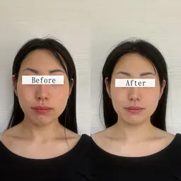 欲張りメニュー【ドライヘッドスパ+小顔矯正】じっくりほぐして流す70分