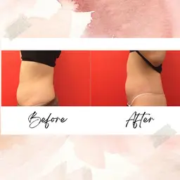 【お腹周りすっきり🌟】オールハンド腸マッサージモニター募集\4,000