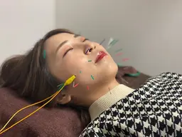 【リフトアップ】💐電気美容鍼(針)＋ローラー鍼＋首のマッサージ💐