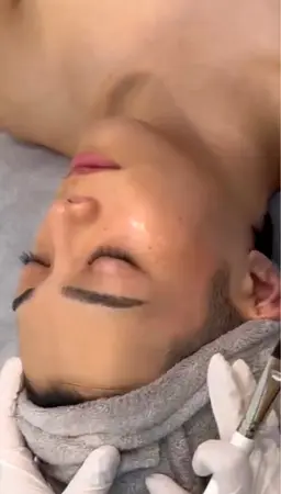 本気の肌質改善！ララピールの進化版『ダクトピール』✨ハイドラ毛穴洗浄付き