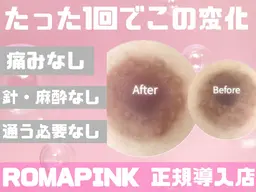 【黒ずみ/メラニンケア】ローマピンク無料カウンセリング