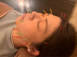 ⭐️小顔鍼練習モデルリピーター募集⭐️５月末まで特別価格❣️継続すると効果アップ⤴️※2回目以降の方はこちらを💁‍♀️