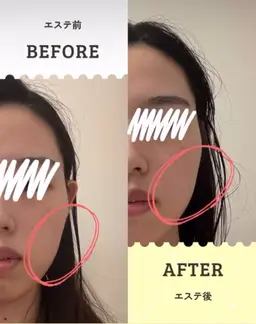 うるおい肌に✨気になる悩みにドライヘッドスパ付きフェイシャルマッサージ