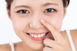 【ミニモ学割】毛穴の黒ずみを改善したい方・5年以上毛穴に悩んでいる方