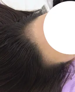 ヘアのスカルプ無料でお問い合わせいただけます♪