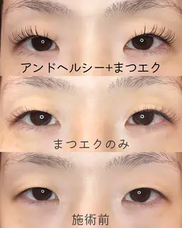 【新感覚👀ぱっちりまつげ】自分史上最高♡話題の&healthy(アンドヘルシー)まつげパーマ×まつエク両目80本