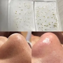 【ご新規様限定】新メニュー！二刀流毛穴エクストラクション（鼻）