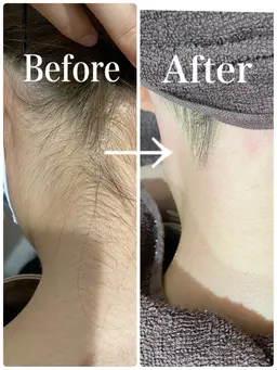 うなじ美人へ✨大人気❤️うなじWax¥4,500→¥3,000