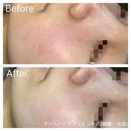 ⚠️現金のみのお支払い⚠️お任せオールハンドフェイシャル50分