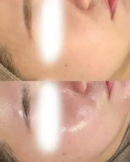 【残り9名様限定クーポン】水光美白WAX