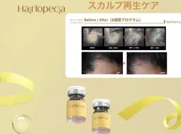 最新スカルプ再生ケア✨頭皮マッサージ+スピキュール導入1ヶ月ホームケア付き