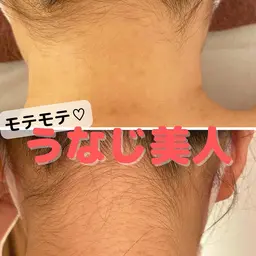 首筋スッキリ✨うなじ脱毛