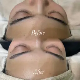 【動画撮影OKな方🎞⟡.·】顔シェービング+パック