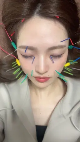 🌻最強小顔コース🌻美容鍼＋小顔矯正＋リンパマッサージ