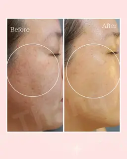 【お悩み：毛穴の開き】たるみ毛穴スキンタイトニングフェイシャル　60分（初回カウンセリング・着替え込み120分）