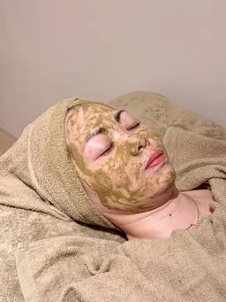 【ミニモ限定】鍼灸師監修🌿3回¥15,000 本格ハーブピーリング