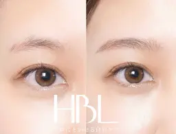 ハリウッドブロウリフト