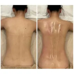 ※現金のみ方限定◎痩身モニター募集(ハイパーナイフとシェイプ短期集中痩身80分8回券→79800円