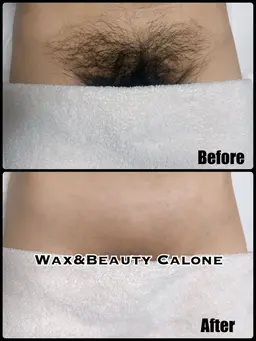 「レディース」VIOブラジリアンワックス