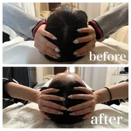 【すぐ効果実感💎】小顔矯正×頭蓋骨矯正フル施術💆♀️通常価格22000円→体験価格3300円