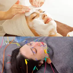 【ぷるん肌】炭酸パック×美容鍼 90分 ✨