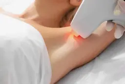 中高生・全身脱毛（顔・VIO省く）