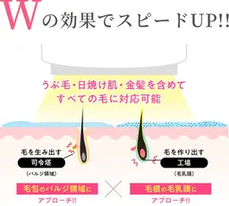 ミニモ限定❤︎全身脱毛1回